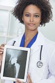 image of medical doctors  - An African American female woman medical doctor in hospital holding a tablet computer with a hip replacement patient X - JPG 